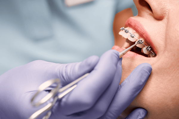 orthodontic payment solutions